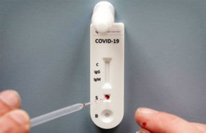 Zestawy do testowania koronawirusa w domu: kiedy będą dostępne